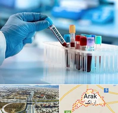آزمایشگاه خون قبل از ازدواج در اراک