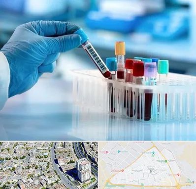 آزمایشگاه خون قبل از ازدواج در قاسم آباد مشهد