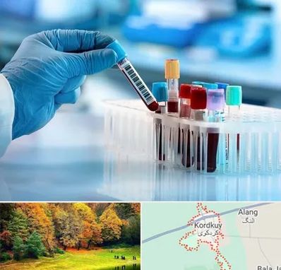 آزمایشگاه خون قبل از ازدواج در کردکوی