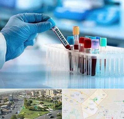 آزمایشگاه خون قبل از ازدواج در کمال شهر کرج