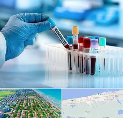 آزمایشگاه خون قبل از ازدواج در فریدونکنار