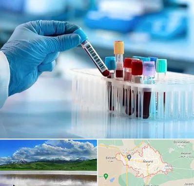 آزمایشگاه خون قبل از ازدواج در مرند