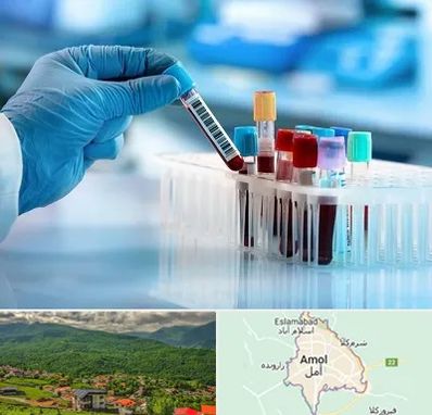 آزمایشگاه خون قبل از ازدواج در آمل