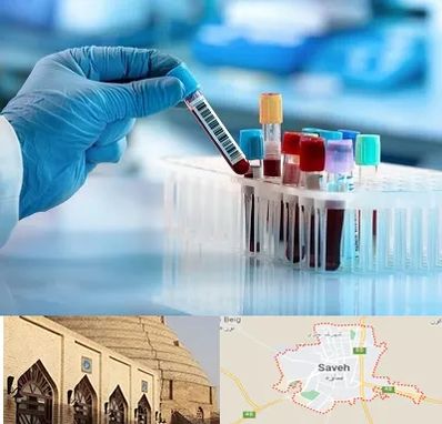 آزمایشگاه خون قبل از ازدواج در ساوه