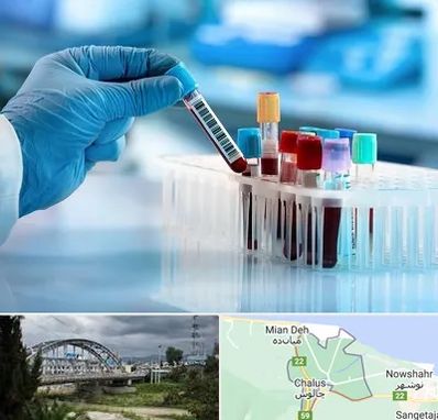 آزمایشگاه خون قبل از ازدواج در چالوس