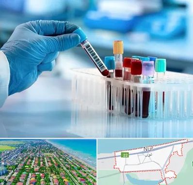 آزمایشگاه خون قبل از ازدواج در نور