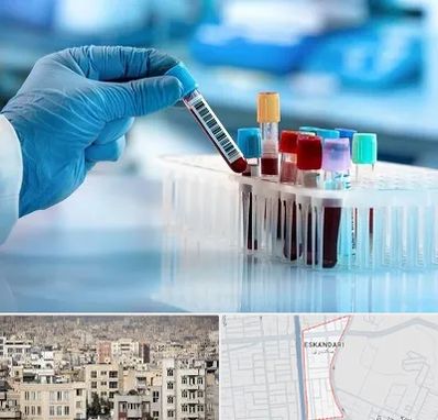 آزمایشگاه خون قبل از ازدواج در اسکندری