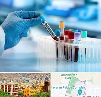 آزمایشگاه خون قبل از ازدواج در نیاوران 