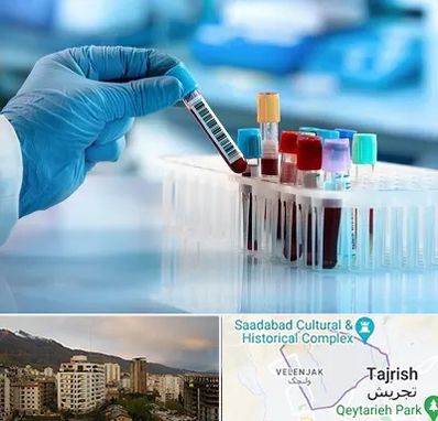 آزمایشگاه خون قبل از ازدواج در زعفرانیه 