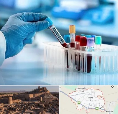 آزمایشگاه خون قبل از ازدواج در بم
