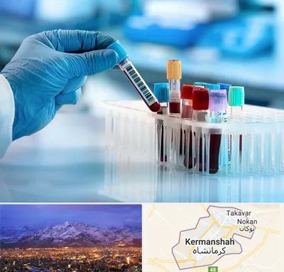آزمایشگاه خون قبل از ازدواج در کرمانشاه