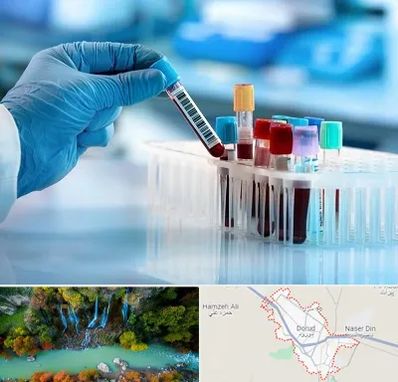 آزمایشگاه خون قبل از ازدواج در دورود