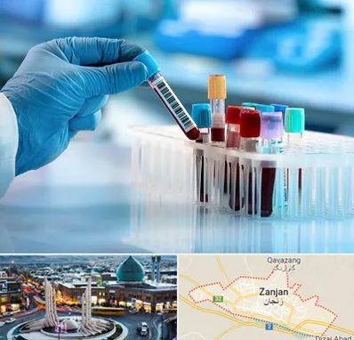 آزمایشگاه خون قبل از ازدواج در زنجان