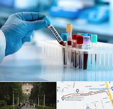 آزمایشگاه خون قبل از ازدواج در بلوار معلم رشت 