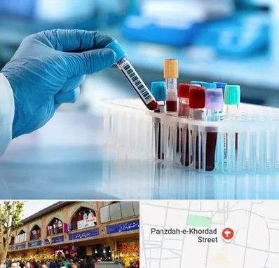 آزمایشگاه خون قبل از ازدواج در 15 خرداد