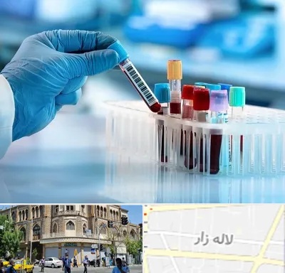 آزمایشگاه خون قبل از ازدواج در لاله زار