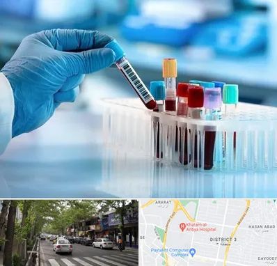 آزمایشگاه خون قبل از ازدواج در ظفر 