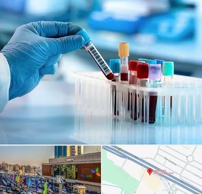 آزمایشگاه خون قبل از ازدواج در لاله پارک تبریز