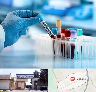 آزمایشگاه خون قبل از ازدواج در وحیدیه شهریار