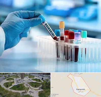 آزمایشگاه خون قبل از ازدواج در ورامین