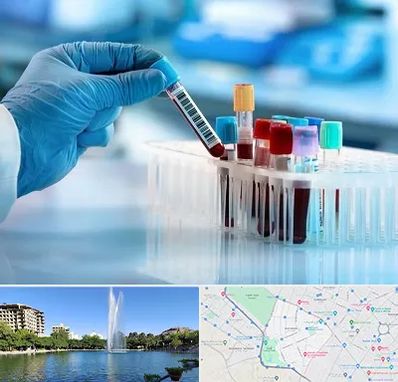 آزمایشگاه خون قبل از ازدواج در کوهسنگی مشهد