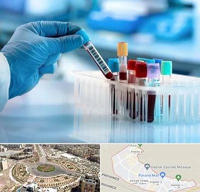آزمایشگاه خون قبل از ازدواج در پرند