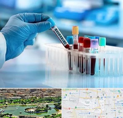 آزمایشگاه خون قبل از ازدواج در منطقه 9 تهران 