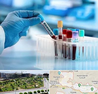 آزمایشگاه خون قبل از ازدواج در پردیس