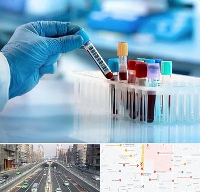 آزمایشگاه خون قبل از ازدواج در توحید 