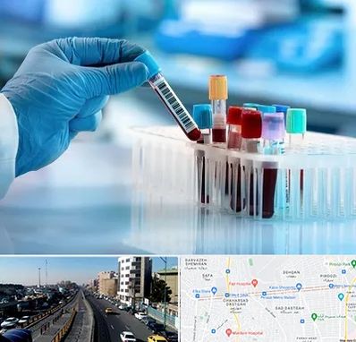 آزمایشگاه خون قبل از ازدواج در پیروزی 