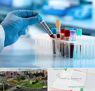 آزمایشگاه خون قبل از ازدواج در تهرانسر 