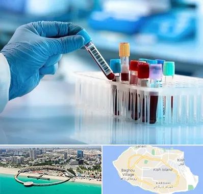 آزمایشگاه خون قبل از ازدواج در کیش
