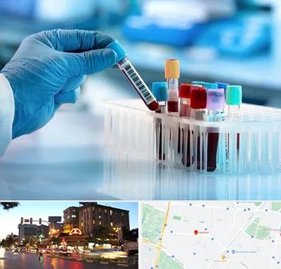 آزمایشگاه خون قبل از ازدواج در بلوار سجاد مشهد