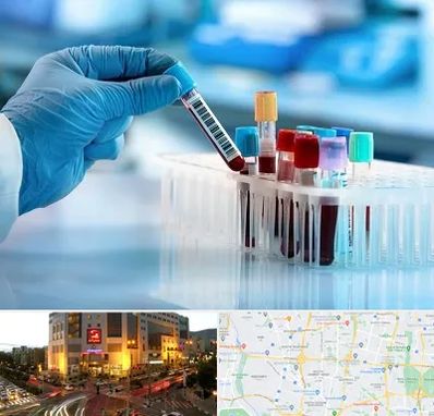 آزمایشگاه خون قبل از ازدواج در جنت آباد تهران 