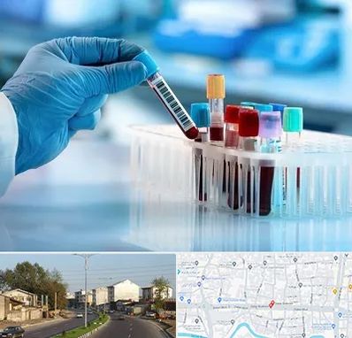 آزمایشگاه خون قبل از ازدواج در ضیابری رشت