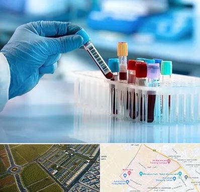 آزمایشگاه خون قبل از ازدواج در الهیه مشهد