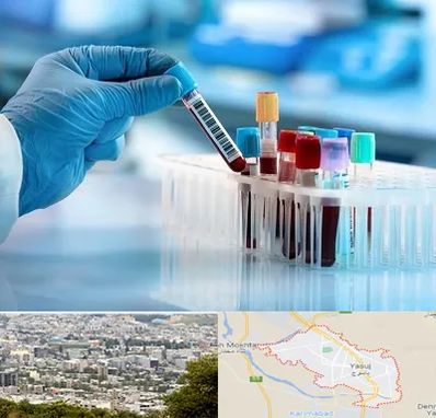 آزمایشگاه خون قبل از ازدواج در یاسوج