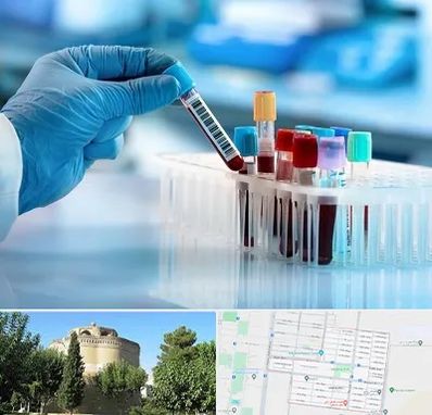 آزمایشگاه خون قبل از ازدواج در مرداویج اصفهان