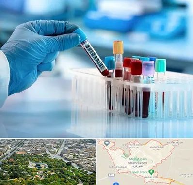 آزمایشگاه خون قبل از ازدواج در شهرکرد