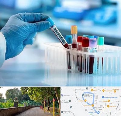 آزمایشگاه خون قبل از ازدواج در بلوار گیلان رشت