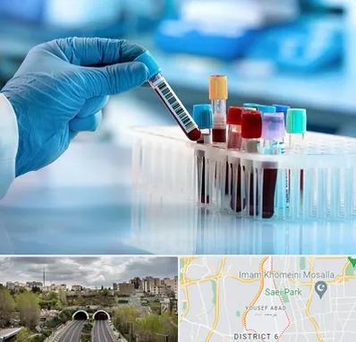 آزمایشگاه خون قبل از ازدواج در یوسف آباد 