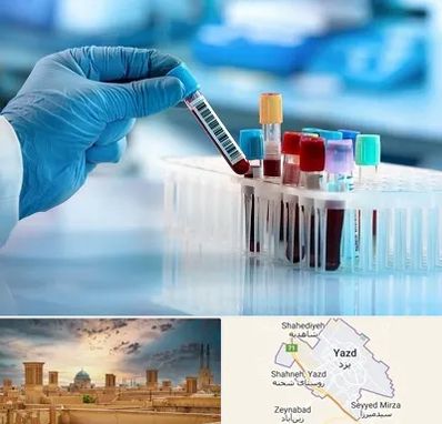 آزمایشگاه خون قبل از ازدواج در یزد