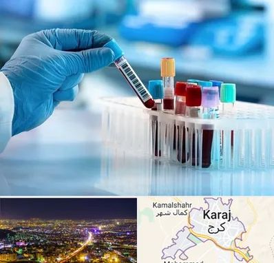 آزمایشگاه خون قبل از ازدواج در کرج