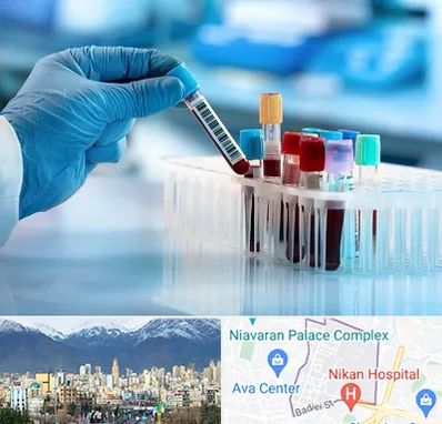 آزمایشگاه خون قبل از ازدواج در آجودانیه 