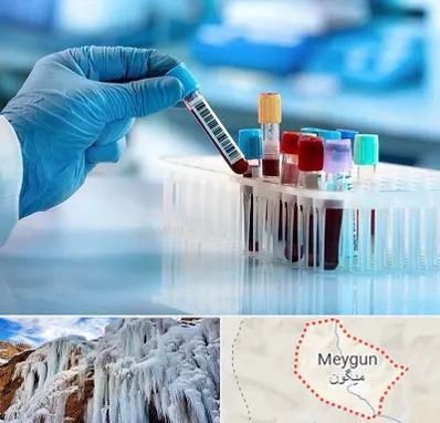 آزمایشگاه خون قبل از ازدواج در میگون
