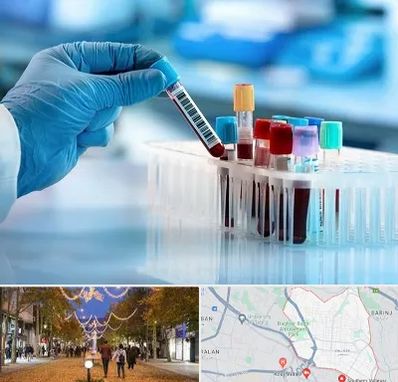 آزمایشگاه خون قبل از ازدواج در ولیعصر ارومیه