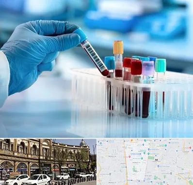 آزمایشگاه خون قبل از ازدواج در منطقه 11 تهران 