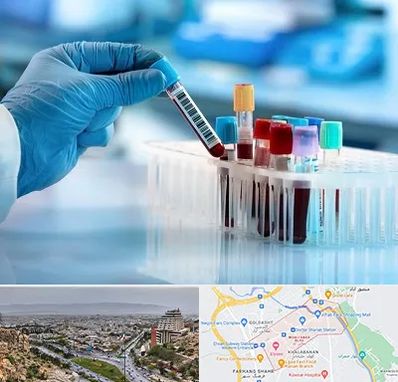 آزمایشگاه خون قبل از ازدواج در معالی آباد شیراز