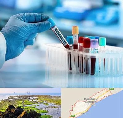 آزمایشگاه خون قبل از ازدواج در بندرلنگه