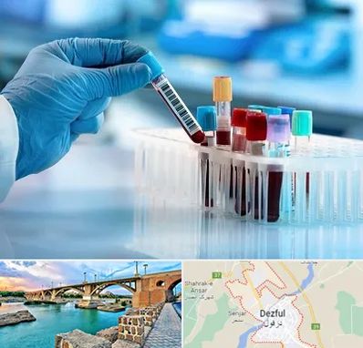 آزمایشگاه خون قبل از ازدواج در دزفول
